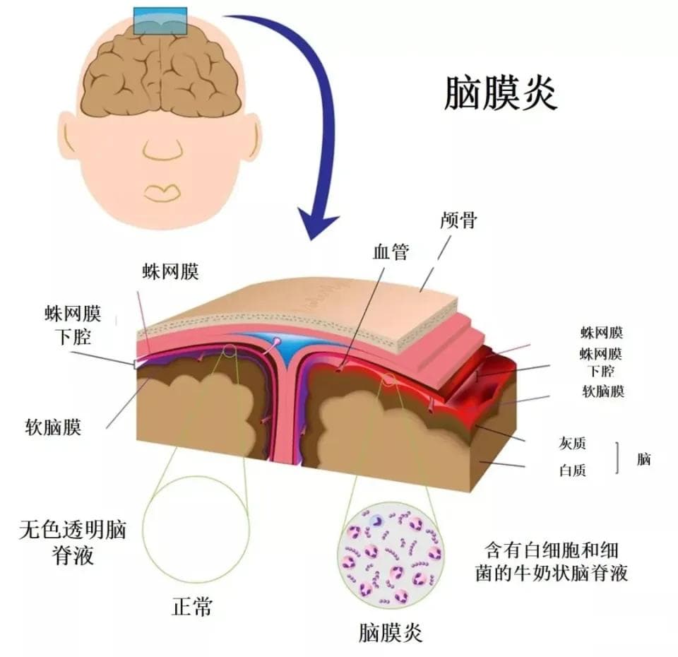 今天去香港打四价流脑结合疫苗，结果跟医生学到了好多知识