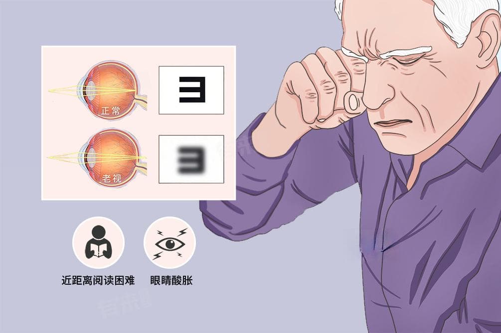 老花眼怎么恢复视力