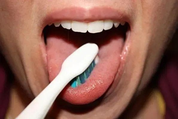 舌头有裂纹，是大病前兆？真相其实是……