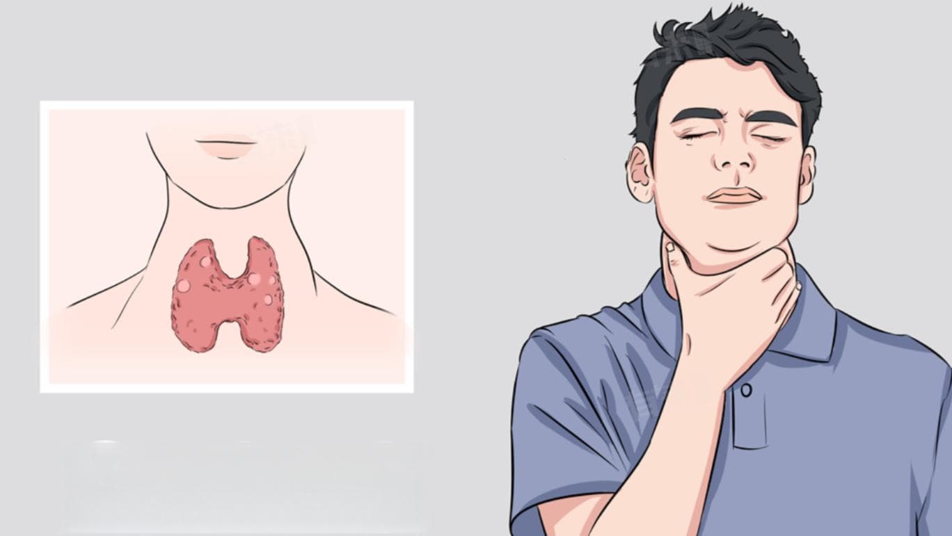 甲状腺囊性结节的五种治疗方法详解