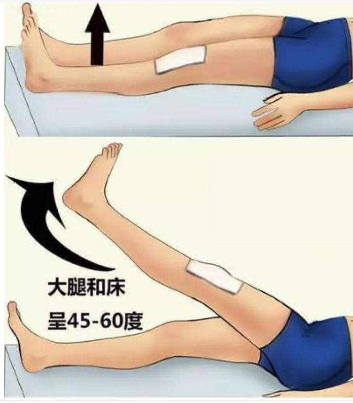 脊髓损伤下肢废用性肌萎缩怎么办？ 积极治疗有效预防下肢肌肉萎缩