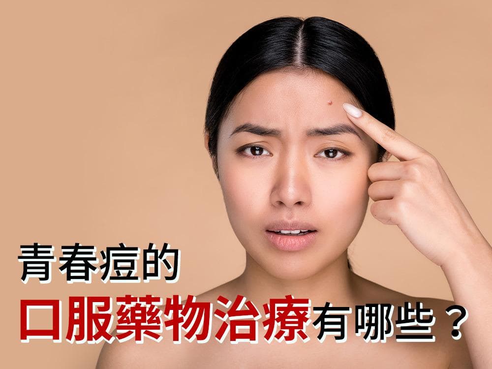 痘痘治疗中口服抗生素的角色：效果与风险全解析