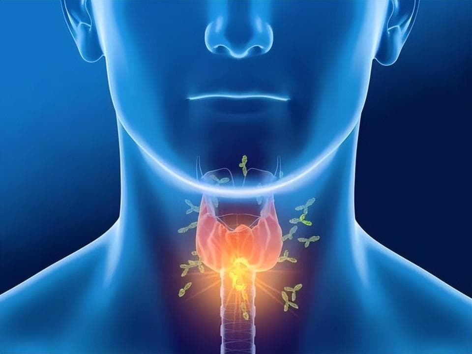 这9类人群小心甲状腺疾病，出现这些症状，及时去医院，做检查！