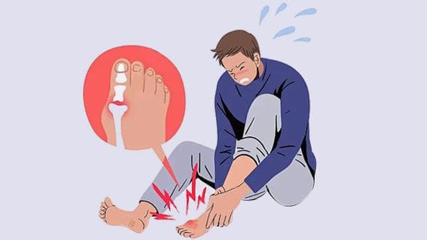 撕脱性骨折不固定，能否自行恢复？