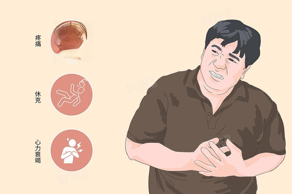 心梗发作时最佳的急救方法是什么
