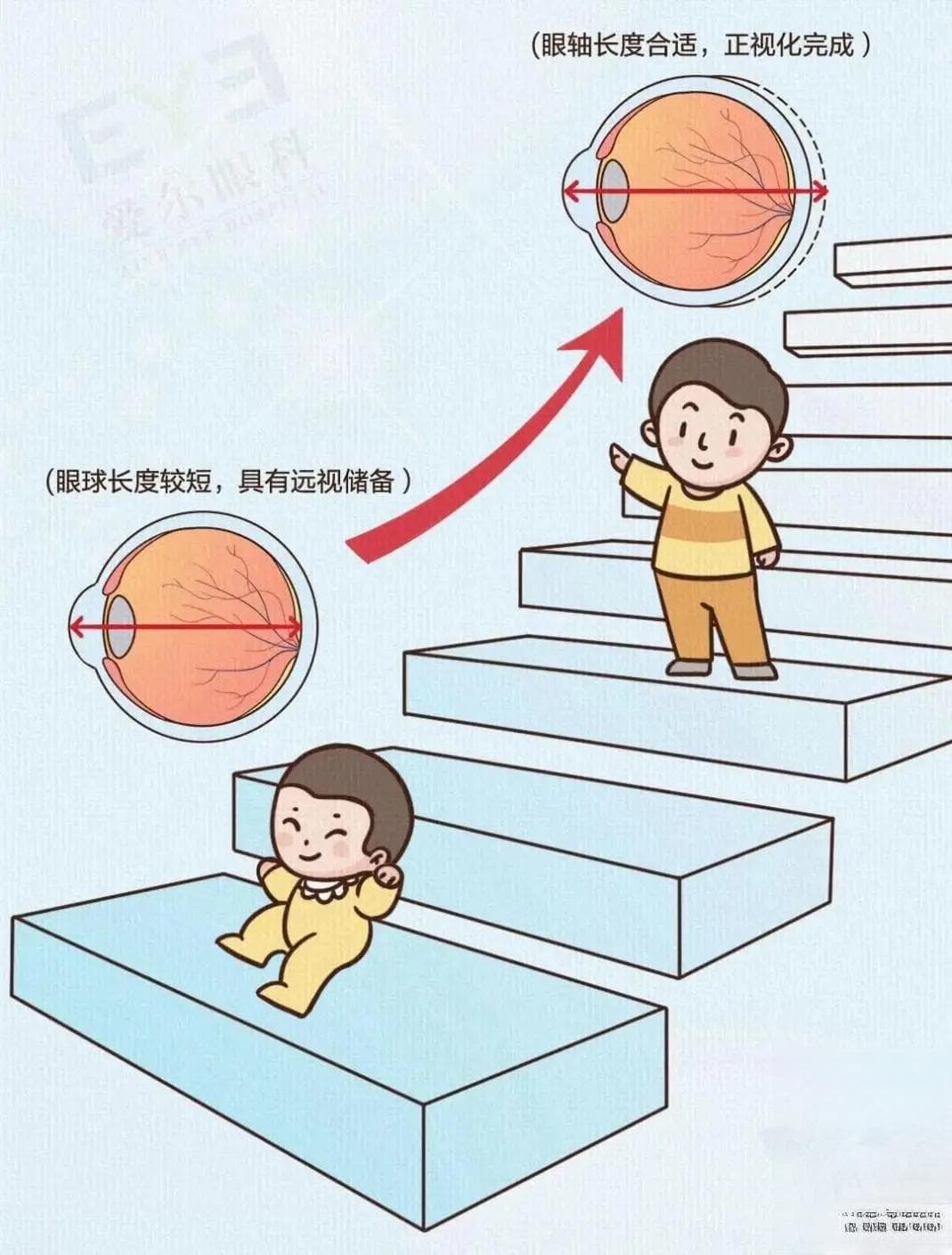 近视为什么治不好？