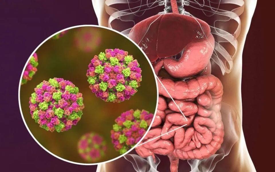 这种病毒去趟厕所就可能感染，呕吐、腹泻是典型症状
