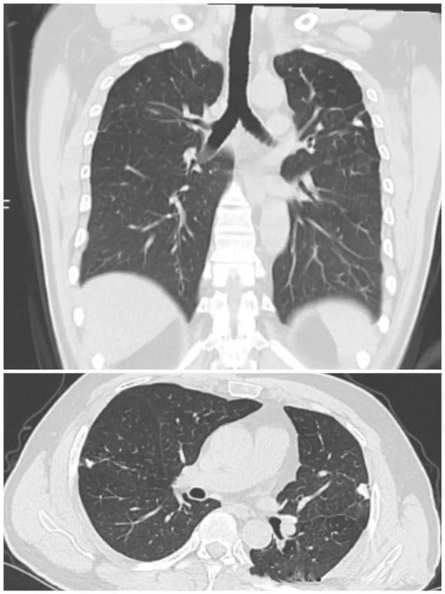 一文读懂！X光、CT、MRI检查该如何选择，看完您就明白啦