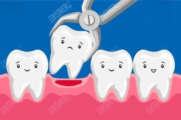 拔了智齿洞多久能长好？1分钟教你如何清理牙洞