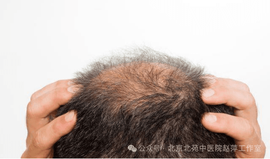 服用优甲乐必看！4大副作用别忽视，医生教你如何避免遭罪
