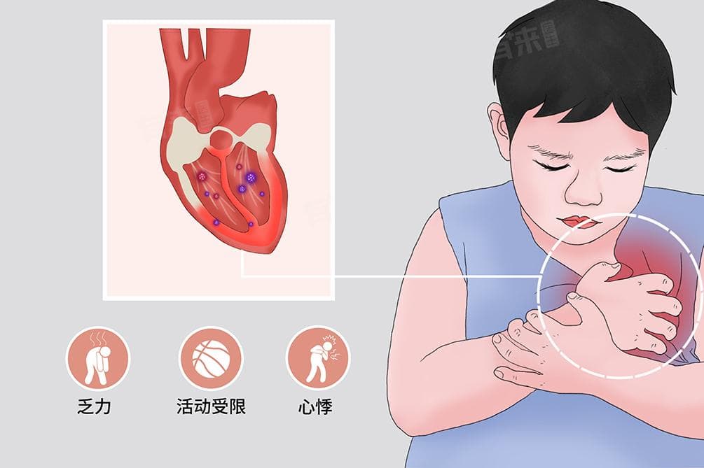 心肌炎一般怎么治疗