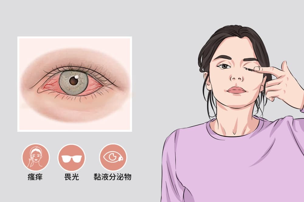 奇痒无比！一夜几百人进急诊，医生提醒：千万不要用手揉搓