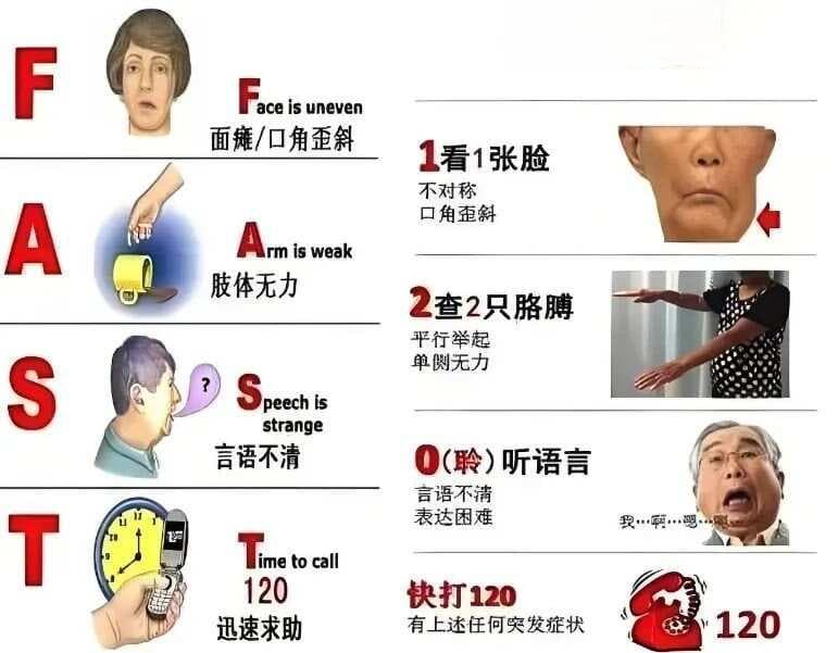 10种常见急救处理汇总