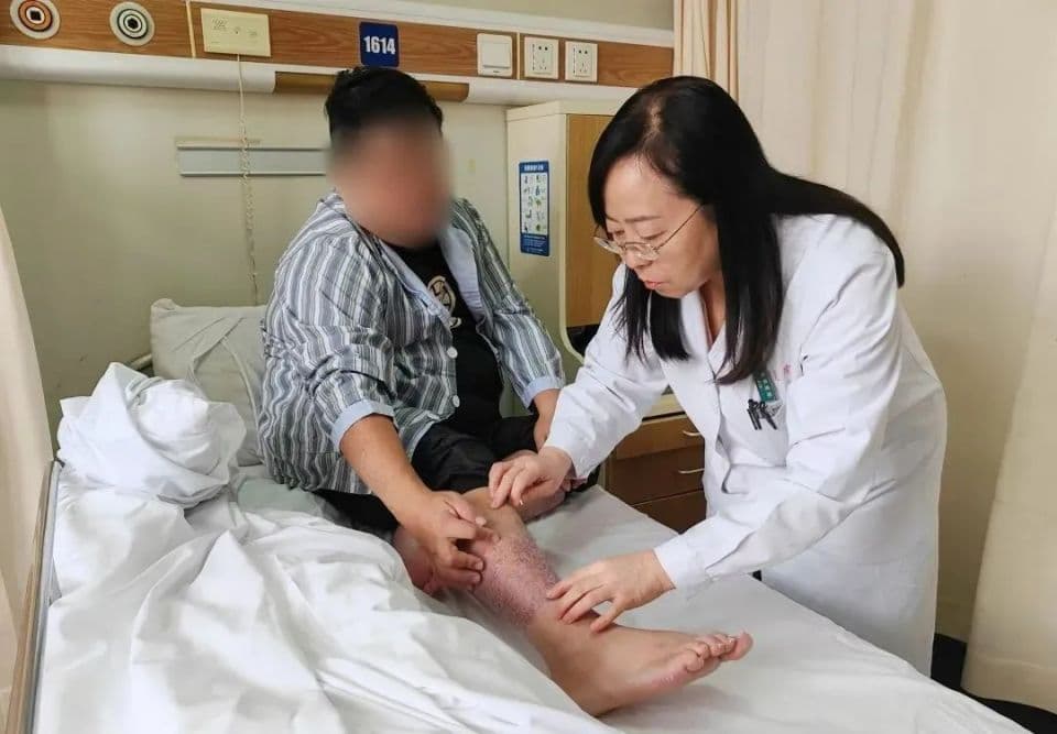 世界银屑病日：正确认识银屑病，走出“银”影