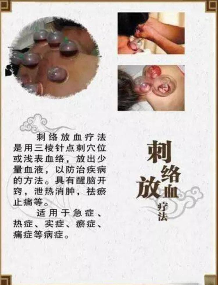 “血出病除”，说说神奇的中医放血疗法
