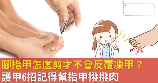 脚趾甲怎么剪才不会反复冻甲？护甲6招记得帮指甲拨拨肉