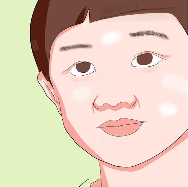 白色糠疹白斑怎么治疗