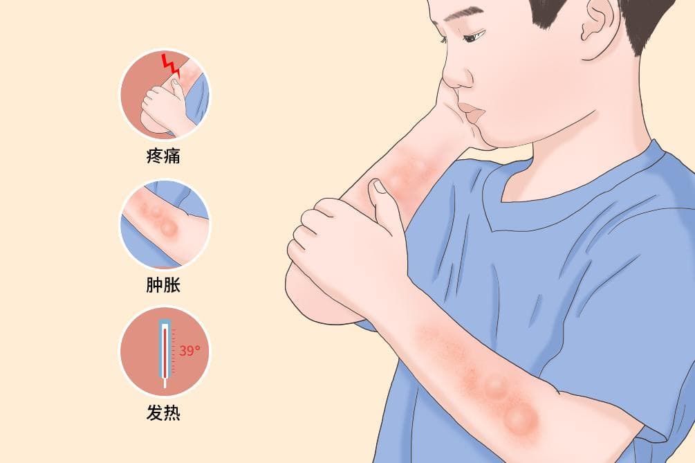 尤文瘤：病因、症状、诊断与治疗全解析