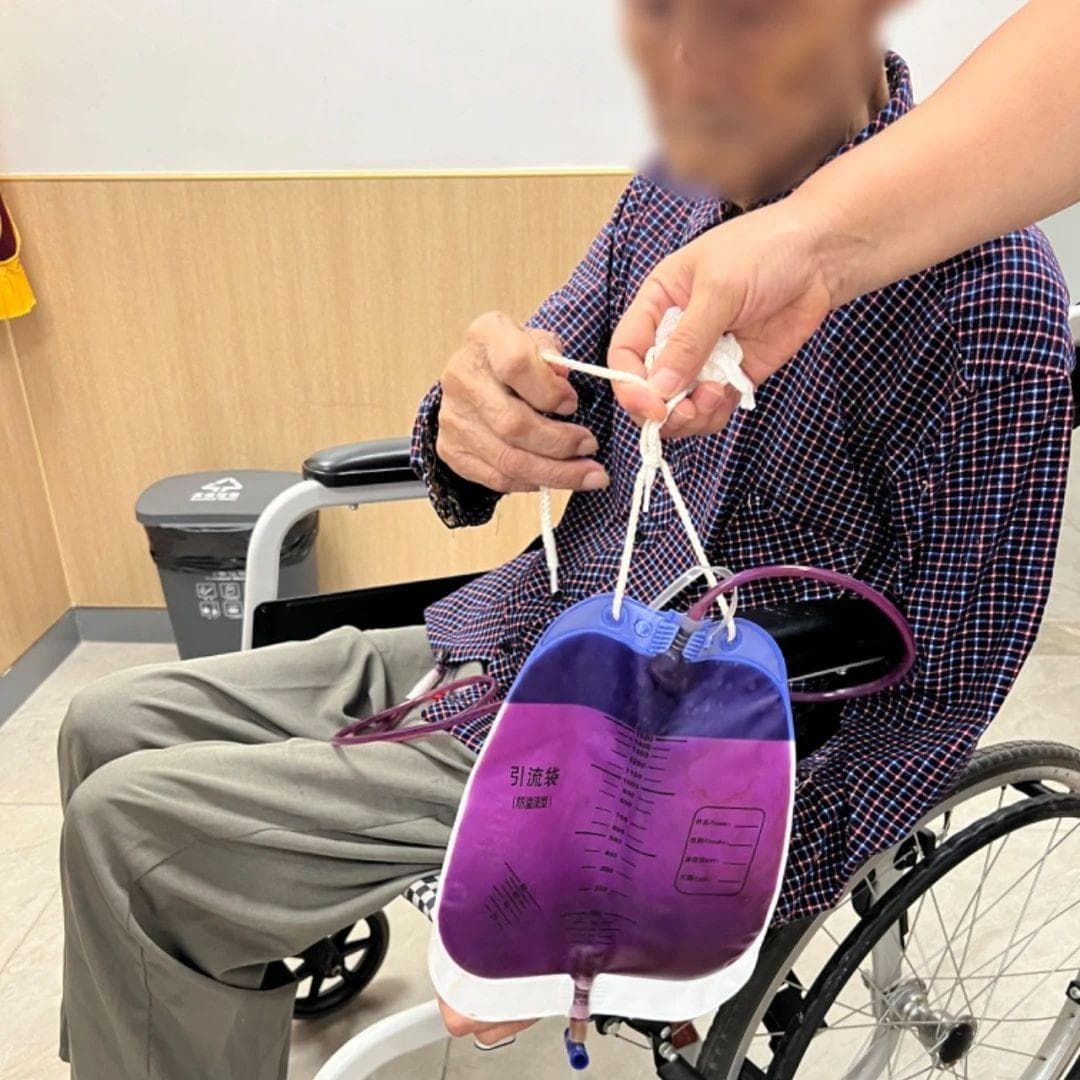 看尿色，辨疾病！小便7种“色号”透露的健康真相