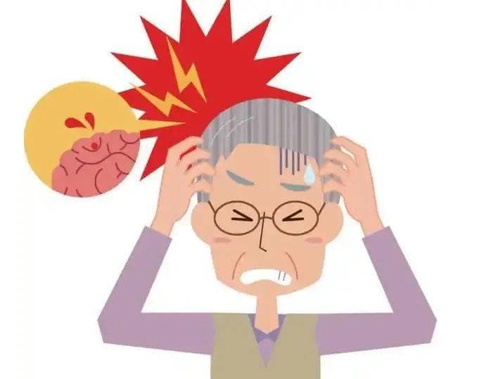 关于脑血管病，你必须要了解的这些事儿