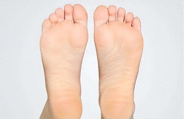 体内有病，“脚底”先知！医生提醒：有这三个特征的人要注意了