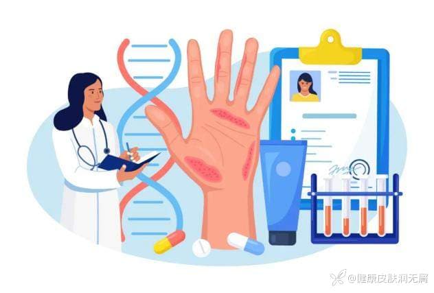 银屑病治疗误区全解析：遗传、传染、复发等问题一文读懂