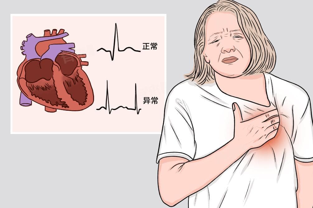 心率过速了