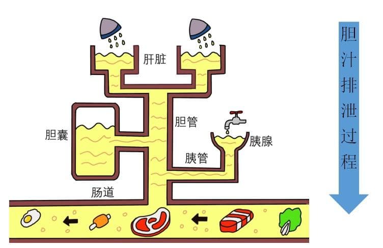 胆囊结石全解析：从成因到预防的全方位指南
