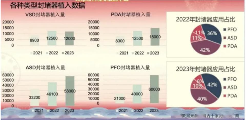 卵圆孔未闭封堵术，为何井喷式开展？