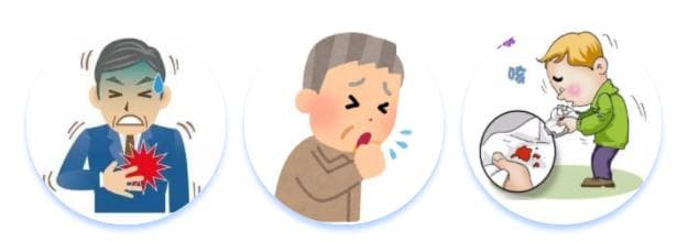 你身边的“猝死之王”——肺栓塞