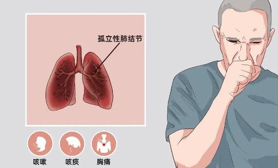 健康科普：什么是孤立性肺结节？
