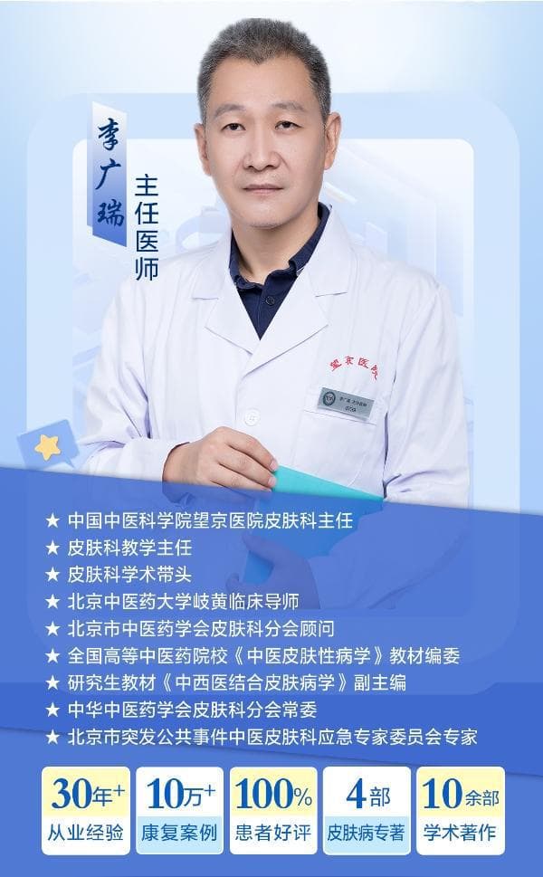 湿疹=过敏？皮科专家李广瑞主任揭秘五大误区