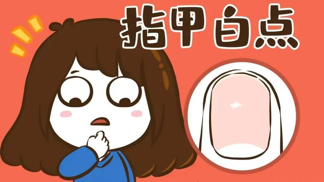 指甲白点真相：多因外伤所致，缺钙表现另有其症