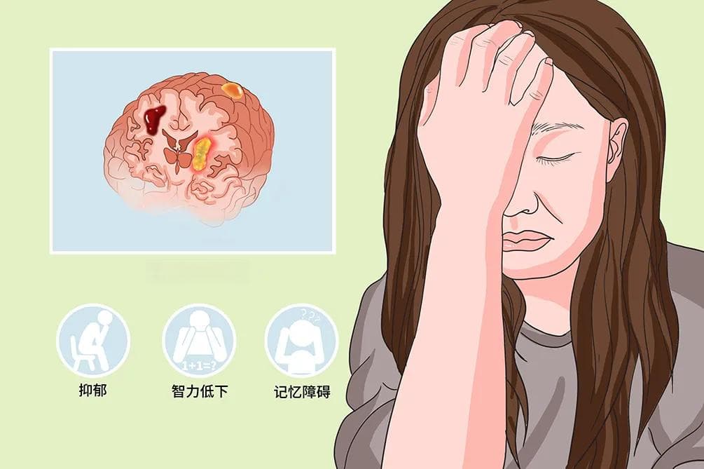 脑器质性精神障碍
