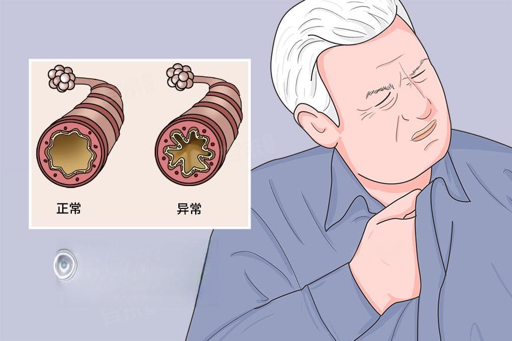 缓解高原反应的小妙招有哪些