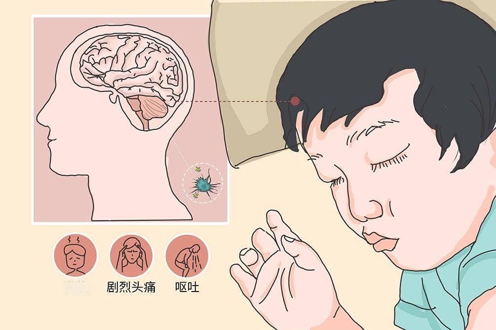 小腿上淋巴结：艾滋病的警示信号还是误解之谜？