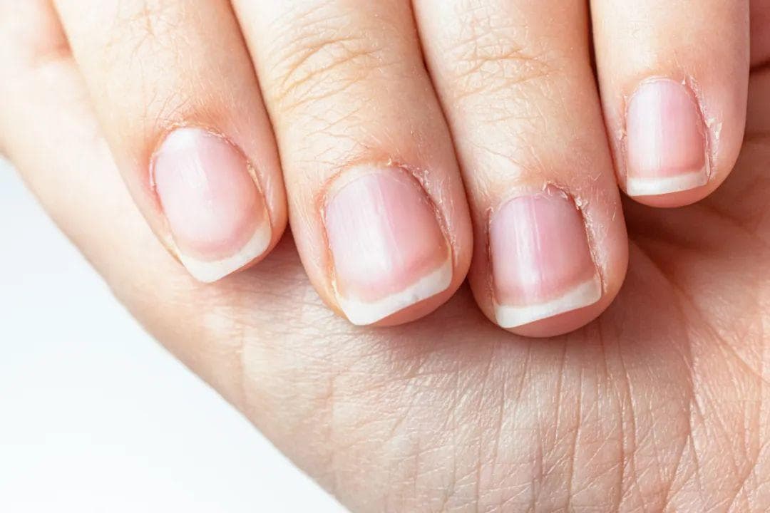 如何通过指甲，判断你的体质特点？