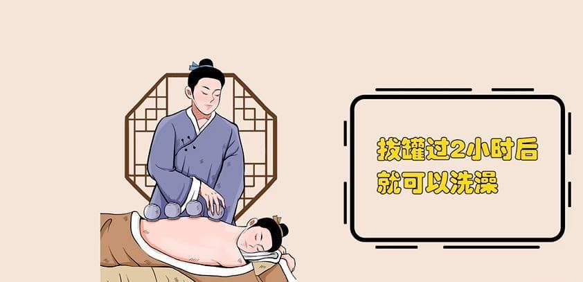 夏天拔罐效果更好？这些关于拔罐的真相你需要知道