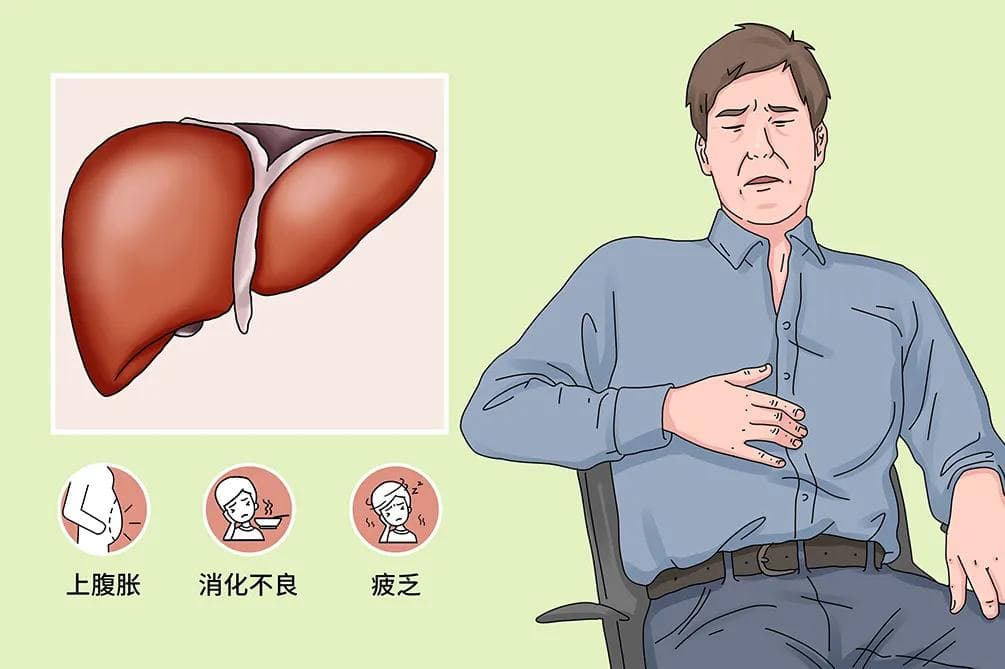 肝大是怎么回事严重吗