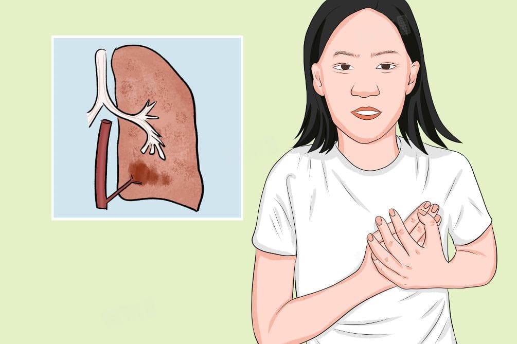 什么叫肺隔离症？病因、症状与治疗全解析