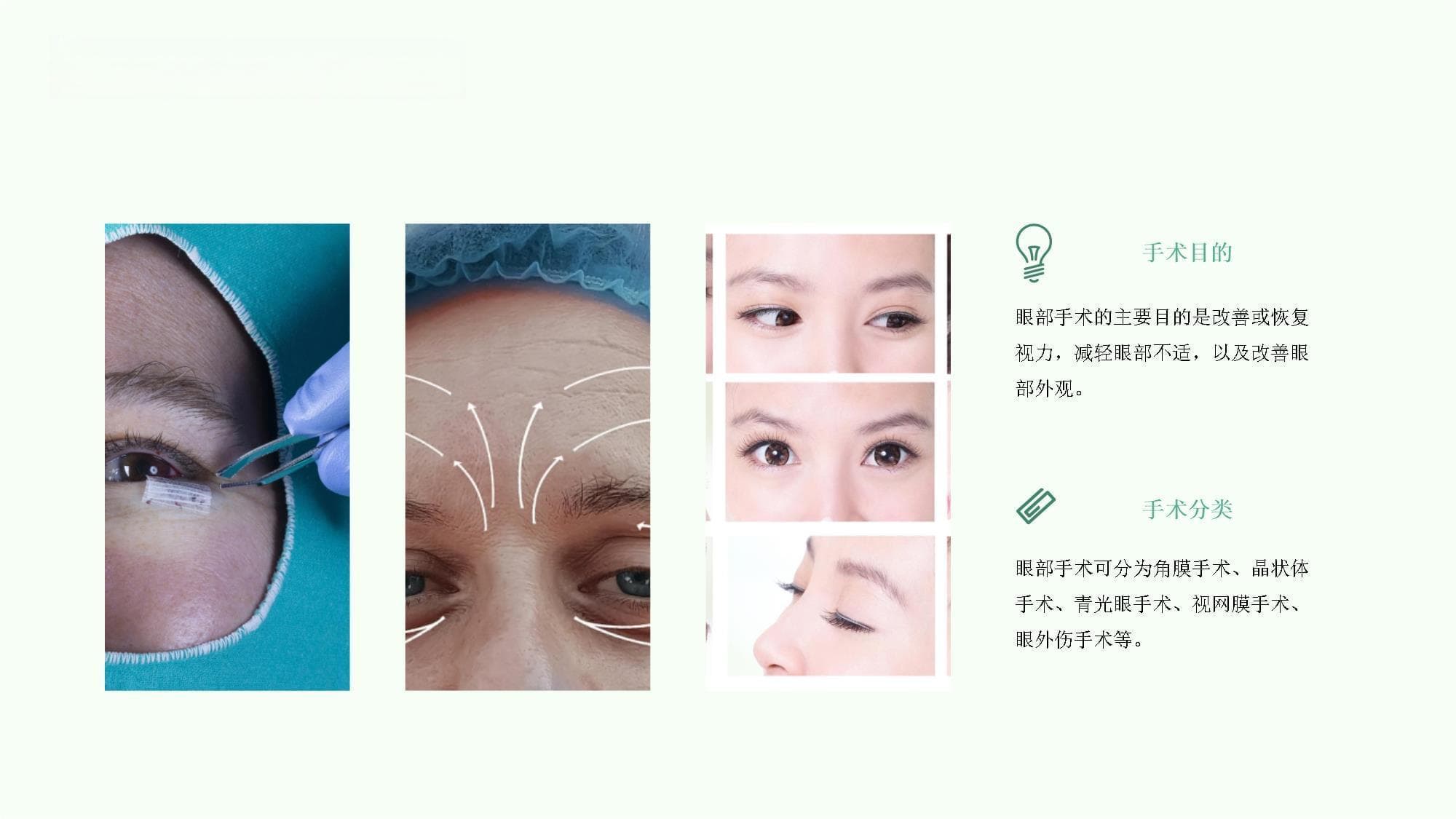 眼部手术方式选择与术后护理指南