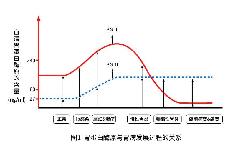 胃蛋白酶原Ⅰ（PGⅠ）的临床意义
