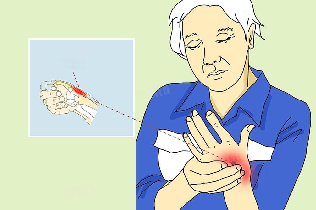 肌腱炎最佳治疗方法