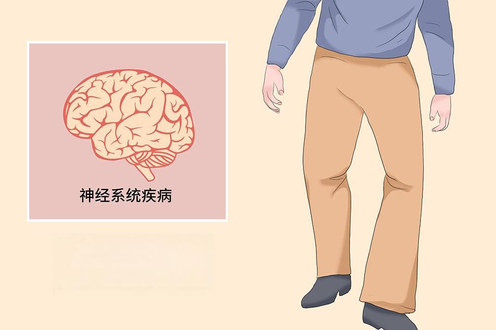 偏瘫步态：症状、诊断与治疗全解析