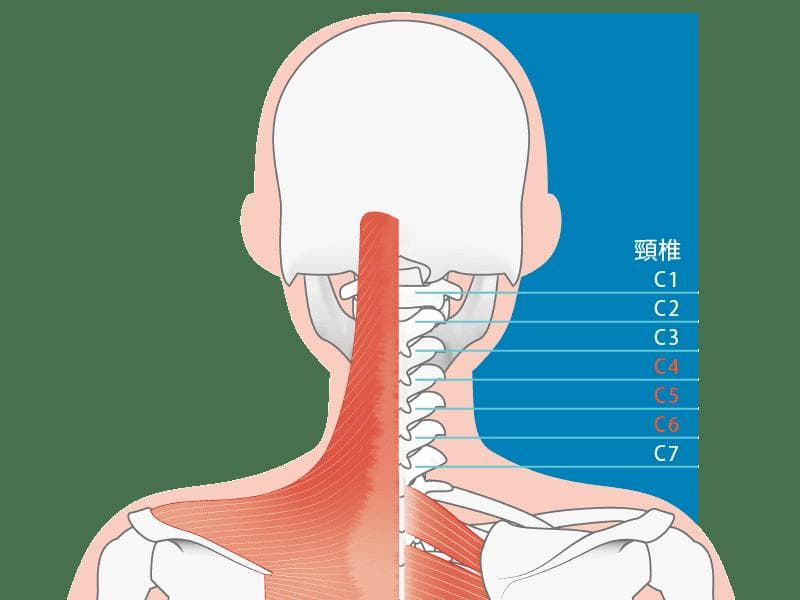 頸椎壓迫神經？認識症狀及舒緩方式，手麻千萬別輕忽
