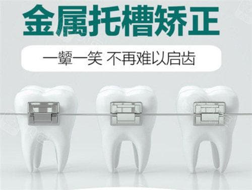 深覆合嘴凸的矫正之路：从基础知识到实操建议
