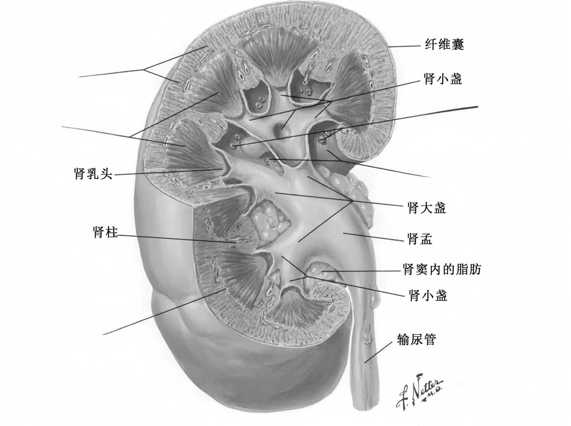 肾结石形成的机制研究进展