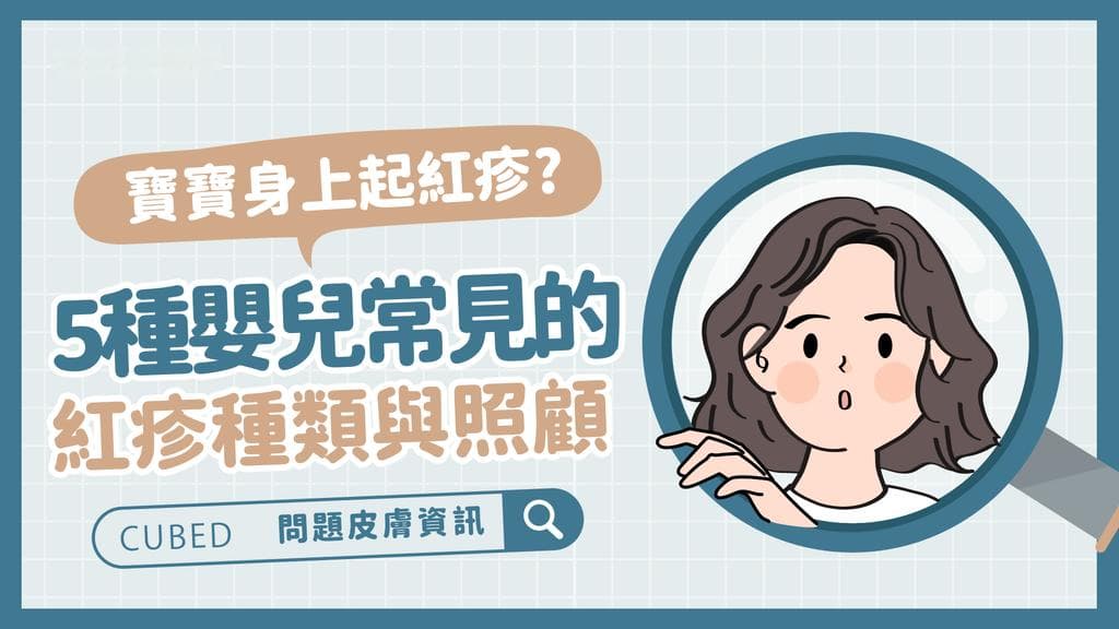 宝宝身上起红疹? 5种婴儿常见红疹种类与照顾