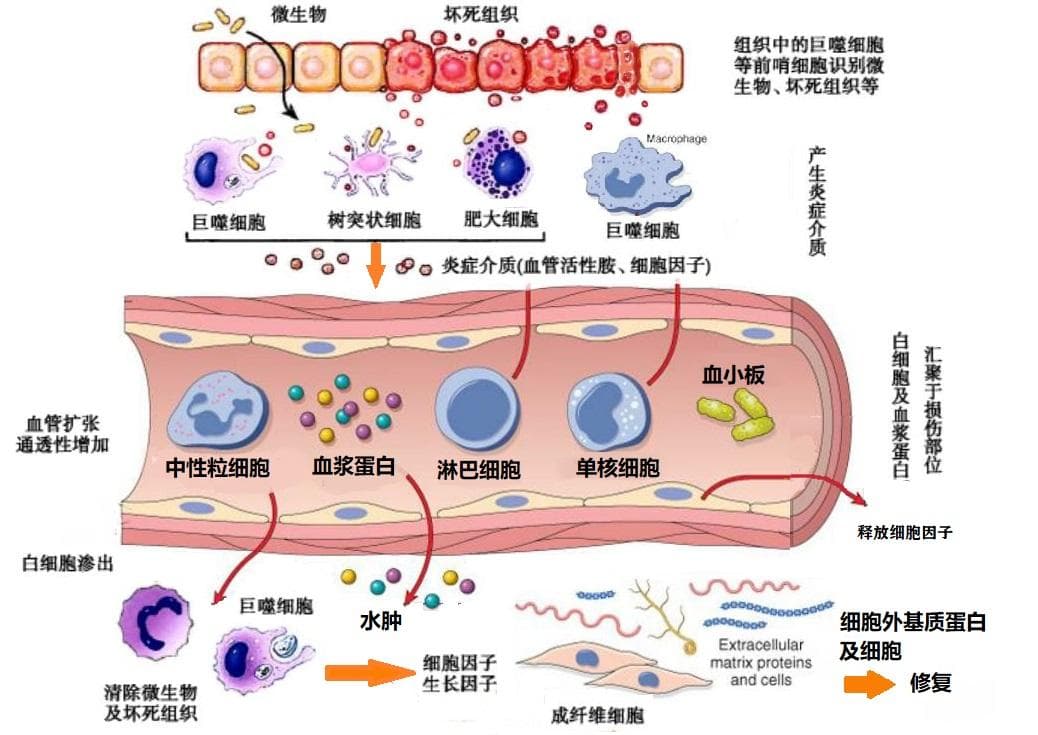 我们不知道答案的125个科学问题(77)慢性炎症