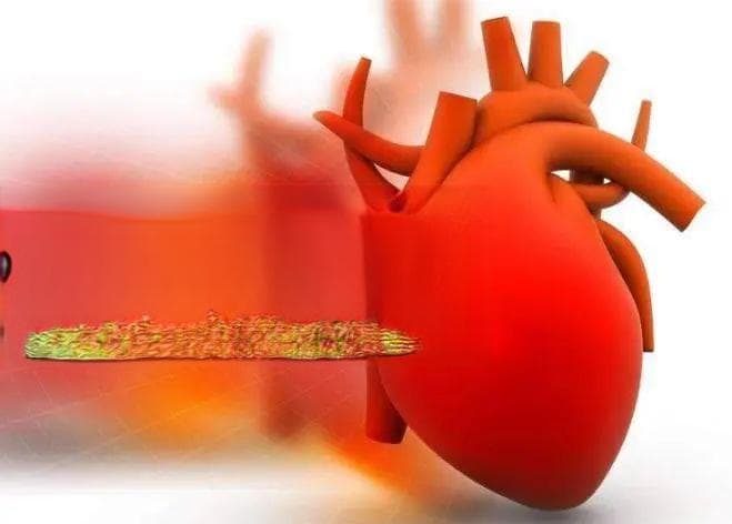 症状多样，不易察觉，心慌、胸闷、乏力……都可能是这种疾病的信号